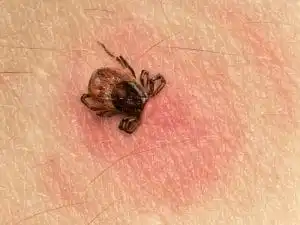 How to Identify a Tick Bite
