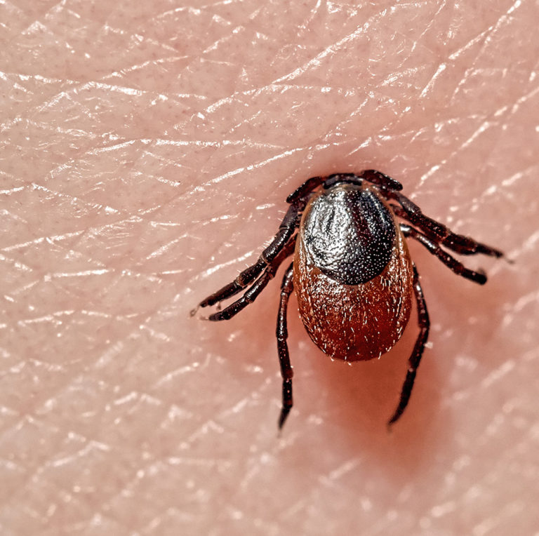 How to Prevent Tick Bites and Tick-Borne Diseases